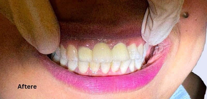 After smile restoration at M&M Dental and Medical Polyclinic